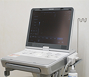 超音波診断装置